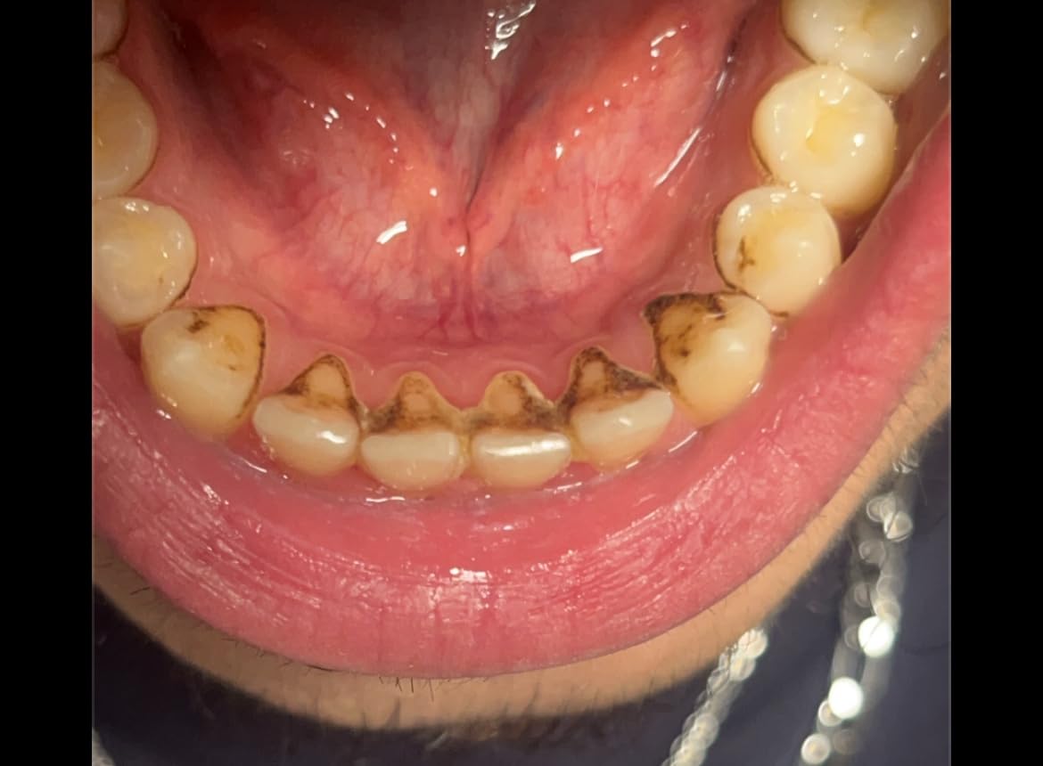 a81a090e1302df47ba4622a9552cc9ac